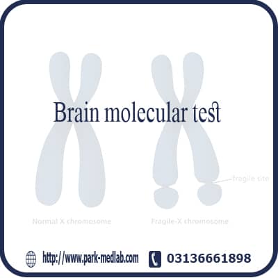 آزمایش کمی متیلاسیون ژن MGMT