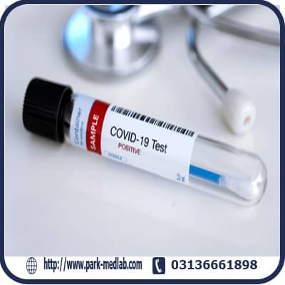 آزمایش خون کرونا IgG (تشخیص سرولوژی) - SARS-CoV-2 IgG
