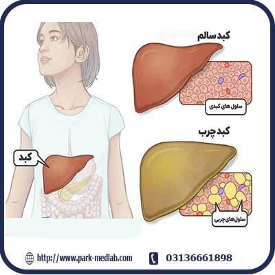 کبد چرب| دلایل اصلی کبد چرب